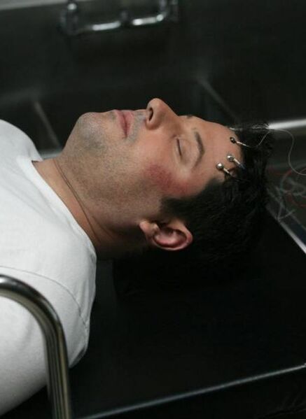 Fichier:1x17 MattElectrodes.jpg